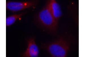 Immunofluorescence (IF) image for anti-zeta-Chain (TCR) Associated Protein Kinase 70kDa (ZAP70) (pTyr319) antibody (ABIN1682143) (ZAP70 抗体  (pTyr319))