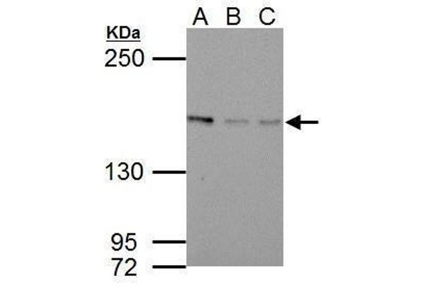 BLM 抗体  (C-Term)