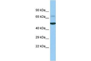 Host: Rabbit Target Name: ACOXL Sample Type: Fetal Liver lysates Antibody Dilution: 1. (ACOXL 抗体  (C-Term))