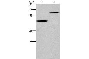 Western Blot analysis of Human hepatocellular carcinoma tissue and Jurkat cell using DOK1 Polyclonal Antibody at dilution of 1:450 (DOK1 抗体)