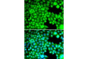 Immunofluorescence analysis of U2OS cells using FABP3 antibody (ABIN5973057). (FABP3 抗体)
