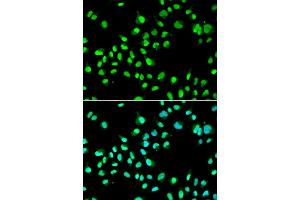Immunofluorescence analysis of A549 cells using GTF2F2 antibody (ABIN5973440). (GTF2F2 抗体)