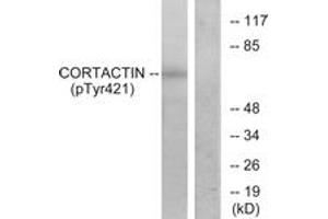 Western Blotting (WB) image for anti-Cortactin (CTTN) (pTyr421) antibody (ABIN2888388) (Cortactin 抗体  (pTyr421))