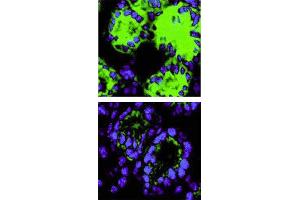 Immunohistochemical staining. (IL-18 抗体)