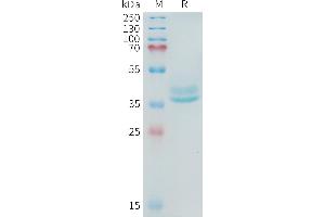 Human A(581-642) Protein, hFc Tag on SDS-PAGE under reducing condition. (ADAM17 Protein (AA 581-642) (Fc Tag))