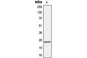 Western blot analysis of Connexin 26 expression in HepG2 (A) whole cell lysates. (GJB2 抗体  (Center))