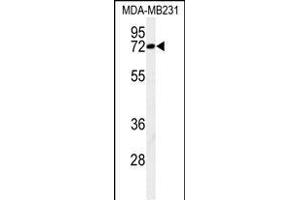 Western blot analysis of C Antibody (N-term) (ABIN650926 and ABIN2839997) in MDA-M cell line lysates (35 μg/lane). (CJ119 (AA 143-171), (N-Term) 抗体)