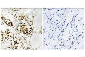 Immunohistochemistry (IHC) image for anti-Regulator of G-Protein Signaling 5 (RGS5) (Internal Region) antibody (ABIN1852006) (RGS5 抗体  (Internal Region))