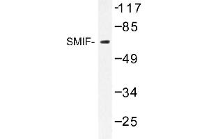 Image no. 1 for anti-DCP1 Decapping Enzyme Homolog A (S. Cerevisiae) (DCP1A) antibody (ABIN272254) (DCP1A 抗体)