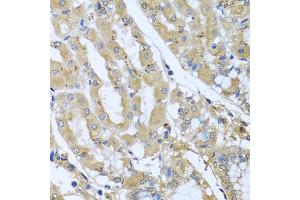 Immunohistochemistry of paraffin-embedded human stomach using STX7 antibody (ABIN5974647) at dilution of 1/100 (40x lens). (Syntaxin 7 抗体)