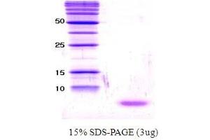 Figure annotation denotes ug of protein loaded and % gel used. (alpha Synuclein 96140 (active) 蛋白)