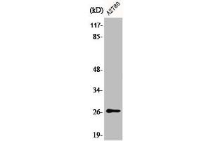 Western Blot analysis of COLO205 cells using Phospho-p27 (S10) Polyclonal Antibody (CDKN1B 抗体  (pSer10))