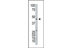 Western Blotting (WB) image for anti-ADP-Ribosyltransferase 3 (ART3) (C-Term) antibody (ABIN357664) (ART3 抗体  (C-Term))