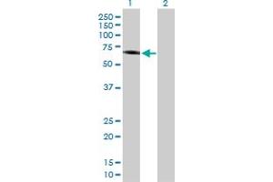 Western Blot analysis of IFNAR1 expression in transfected 293T cell line by IFNAR1 MaxPab polyclonal antibody. (IFNAR1 抗体  (AA 1-557))