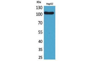 Western Blotting (WB) image for anti-Fc Receptor-Like 5 (FCRL5) (Internal Region) antibody (ABIN6287249) (FCRL5 抗体  (Internal Region))