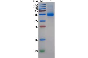 Human MIF Protein, hFc Tag on SDS-PAGE under reducing condition. (MIF Protein (AA 2-115) (Fc Tag))
