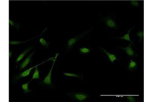 Immunofluorescence of monoclonal antibody to GSTP1 on HeLa cell. (GSTP1 抗体  (AA 1-210))