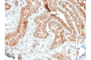 Immunohistochemistry (IHC) image for anti-V-Akt Murine Thymoma Viral Oncogene Homolog 1 (AKT1) (AA 85-189) antibody (ABIN6939338)