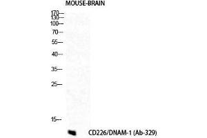 Western Blot (WB) analysis of Mouse Brain cells using DNAM-1 Polyclonal Antibody. (CD226 抗体  (Tyr570))
