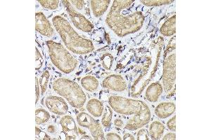 Immunohistochemistry of paraffin-embedded mouse kidney using METTL4 Rabbit pAb (ABIN6133091, ABIN6143773, ABIN6143774 and ABIN6224964) at dilution of 1:100 (40x lens). (METTL4 抗体  (AA 1-190))