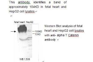 Image no. 1 for anti-Catenin (Cadherin-Associated Protein), alpha 1, 102kDa (CTNNA1) antibody (ABIN790787) (CTNNA1 抗体)