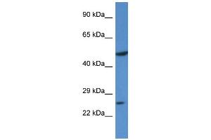 Western Blotting (WB) image for anti-Kruppel-Like Factor 17 (KLF17) (N-Term) antibody (ABIN405290) (KLF17 抗体  (N-Term))