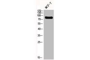 Western Blot analysis of MCF7 cells using GIT2 Polyclonal Antibody (GIT2 抗体  (Internal Region))