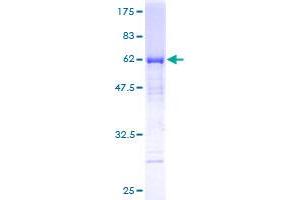 MTUS1 Protein (AA 1-240) (GST tag)