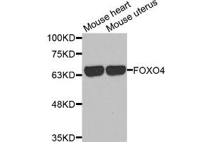 Western Blotting (WB) image for anti-Forkhead Box O4 (FOXO4) antibody (ABIN1872735) (FOXO4 抗体)