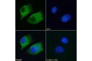 Immunofluorescence staining of A549 cells using anti-RAGE antibody  2A11. (Recombinant RAGE 抗体)