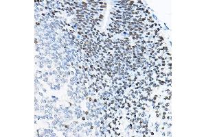 Immunohistochemistry of paraffin-embedded mouse fetal Brain using SOX2 Rabbit pAb (ABIN6130648, ABIN6148295, ABIN6148297 and ABIN6215241) at dilution of 1:100 (40x lens). (SOX2 抗体  (AA 1-140))