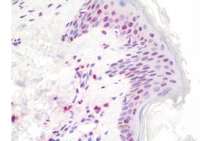 Human Skin: Formalin-Fixed, Paraffin-Embedded (FFPE) (Histone H4 抗体)