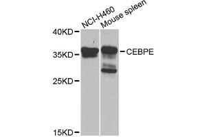 Western blot analysis of extracts of various cell lines, using CEBPE antibody (ABIN5975692) at 1/1000 dilution. (CEBPE 抗体)