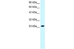WB Suggested Anti-FLJ11730 Antibody Titration: 0. (FLJ11730 (N-Term) 抗体)