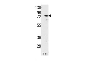 Western blot analysis of PKC delta using rabbit polyclonal PKC delta Antibody using 293 cell lysates (2 ug/lane) either nontransfected (Lane 1) or transiently transfected with the PRKCD gene (Lane 2). (PKC delta 抗体  (N-Term))