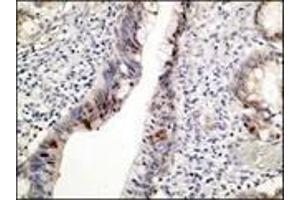 Immunohistochemistry (IHC) image for anti-Tumor Protein P53 (TP53) (C-Term) antibody (ABIN870346) (p53 抗体  (C-Term))