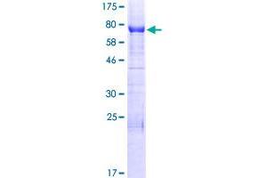 Image no. 1 for Inverted Formin, FH2 and WH2 Domain Containing (INF2) (AA 1-337) protein (GST tag) (ABIN1307903) (INF2 Protein (AA 1-337) (GST tag))