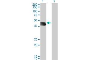 Western Blot analysis of GENX-3414 expression in transfected 293T cell line by GENX-3414 monoclonal antibody (M03), clone 4H4. (STBD1 抗体  (AA 1-358))