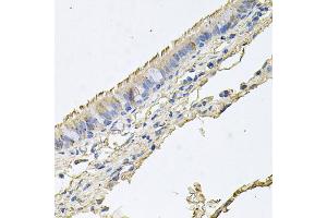 Immunohistochemistry of paraffin-embedded human trachea using EPOR antibody. (EPOR 抗体)