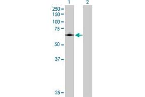 Western Blot analysis of PTGS1 expression in transfected 293T cell line by PTGS1 MaxPab polyclonal antibody. (PTGS1 抗体  (AA 1-599))