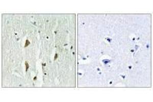 Immunohistochemistry analysis of paraffin-embedded human brain tissue using PAK1/2/3 (Ab-423/402/421) antiobdy. (PAK1/2/3 抗体  (Thr402, Thr421, Thr423))