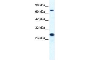 Western Blotting (WB) image for anti-Minichromosome Maintenance Complex Component 6 (MCM6) antibody (ABIN2461394) (MCM6 抗体)