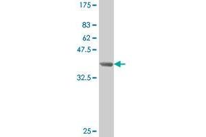 Western Blot detection against Immunogen (39. (SMAD3 抗体  (AA 147-270))