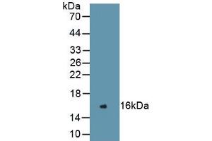 Western Blotting (WB) image for Renin (REN) ELISA Kit (ABIN6574235)