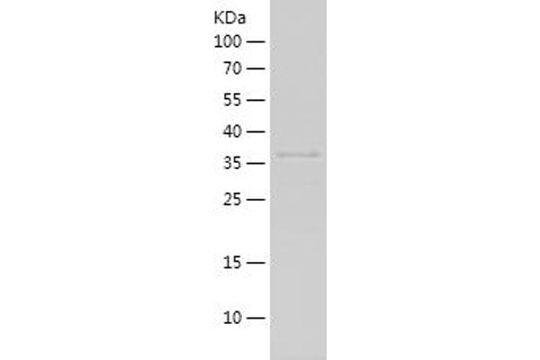 RPLP0 Protein (AA 33-169) (His-IF2DI Tag)