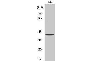 Western Blotting (WB) image for anti-Jun Proto-Oncogene (JUN) (Ser646) antibody (ABIN3183299) (C-JUN 抗体  (Ser646))