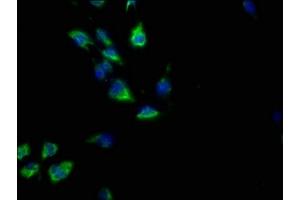 Immunofluorescence staining of U251 cells with ABIN7139867 at 1:50, counter-stained with DAPI. (GNG2 抗体  (AA 44-62))