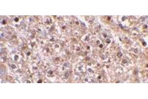 Immunohistochemical staining of Caspase-12 in mouse liver using Caspase-12 antibody at 2μg/ml. (Caspase 12 抗体  (AA 100-116))