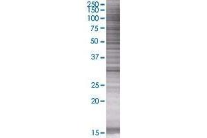 CBR1 transfected lysate. (CBR1 293T Cell Transient Overexpression Lysate(Denatured))