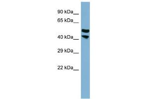 WB Suggested Anti-FLJ14213 Antibody Titration:  0. (FLJ14213 (Middle Region) 抗体)